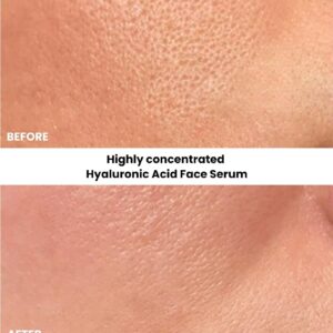 Kleem Organics Hyaluronic Acid Serum – Deep Hydration, Anti-Aging, All Skin Types - 1 Fl. Oz - Image 4